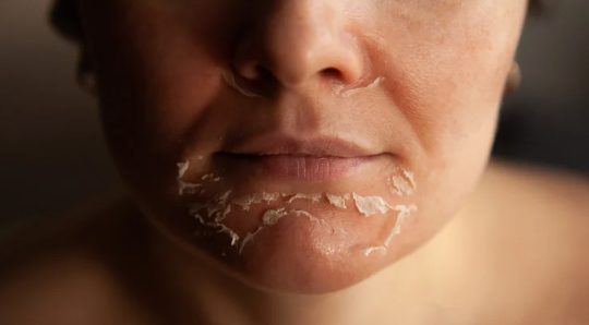 Skin Envie clinical brightening peel