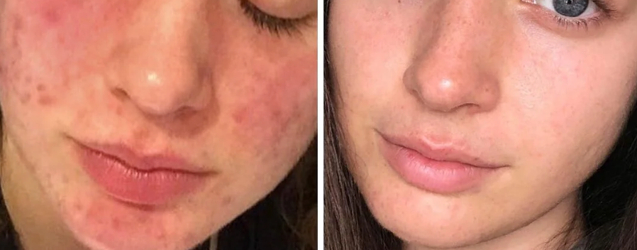 Clear & Calm Clarity Facial