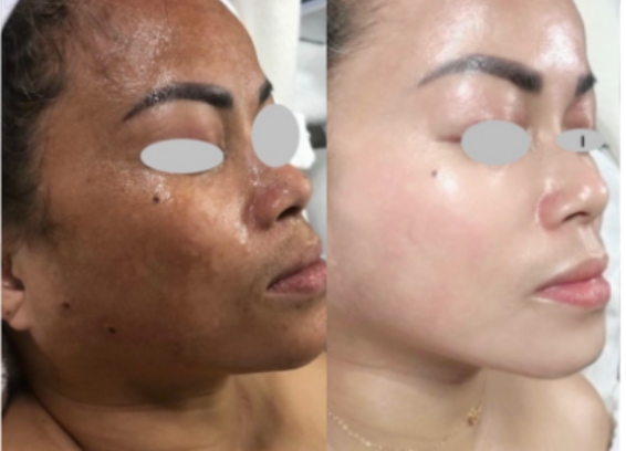 SEA Skin Brightening